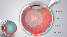 Injection training video 